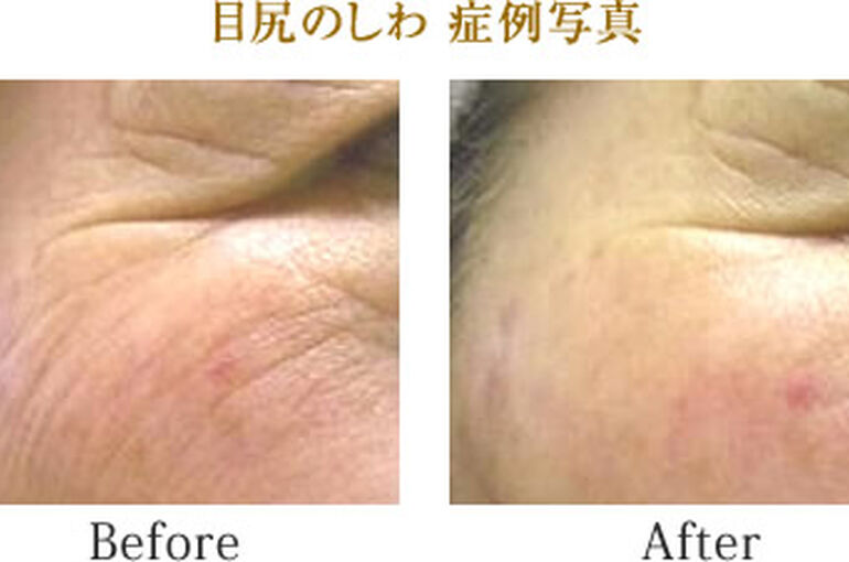 shiwa_img02
